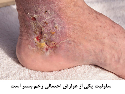 عوارض زخم بستر