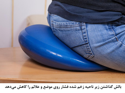 درمان زخم بستر
