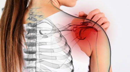 علائم یخ‌زدگی شانه چیست