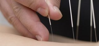 طب سوزنی می‌تواند به تسکین درد کمک کند