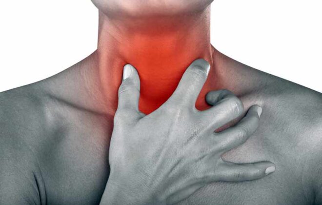 dysphagia in adults