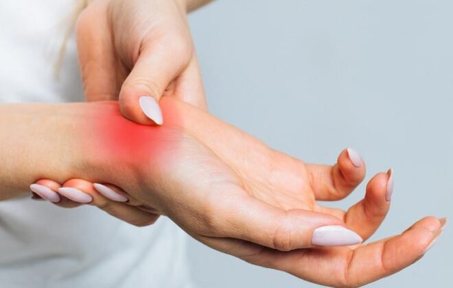 آرتروز مچ دست