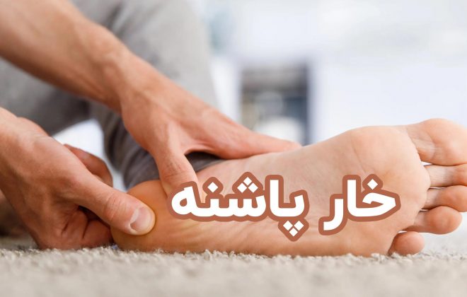 خار پاشنه