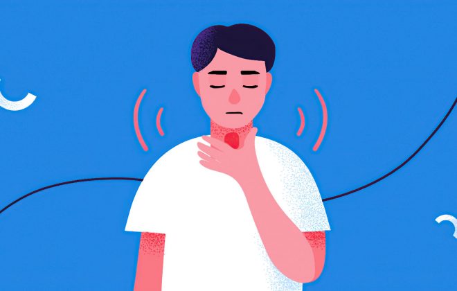 اختلال بلع
