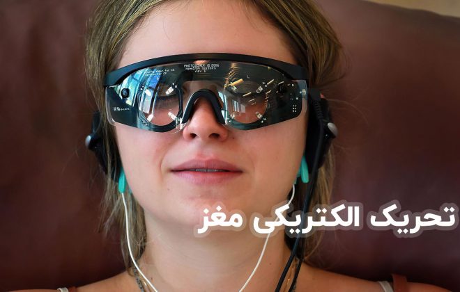 تحریک الکتریکی مغز