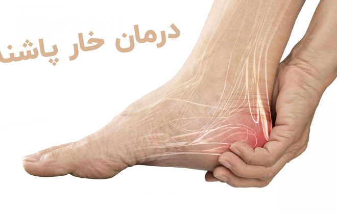 درمان خار پاشنه