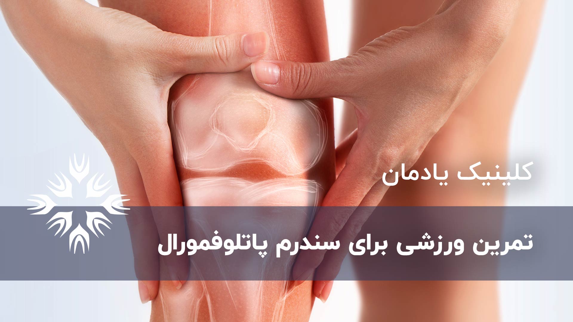 تمرین ورزشی برای سندرم پاتلوفمورال
